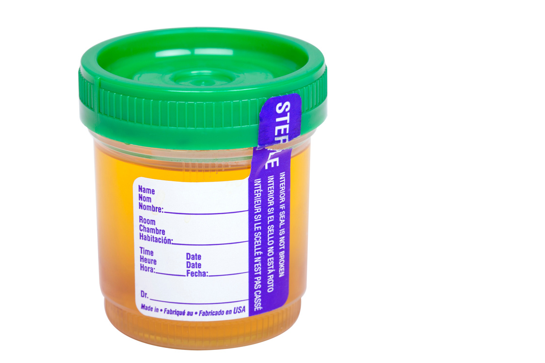 urine sample